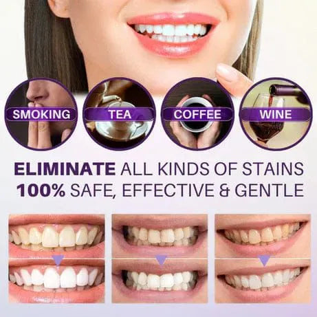 Hismile V34 Purple Teeth Whitening Toothpaste Kit