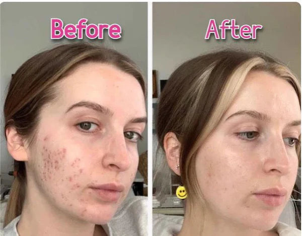 EMS Face Lifting Massager | 7-in-1 Facial LED Sculptor