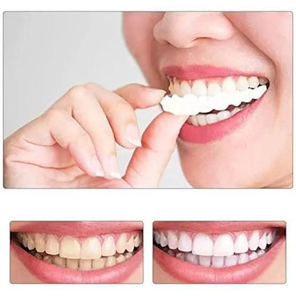 Snap-On Teeth Veneers Flexible Cosmetic Dentures for Men & Women