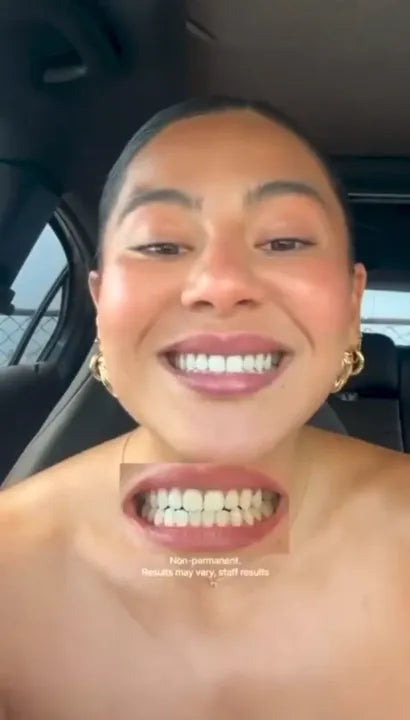 Hismile V34 Purple Teeth Whitening Toothpaste Kit