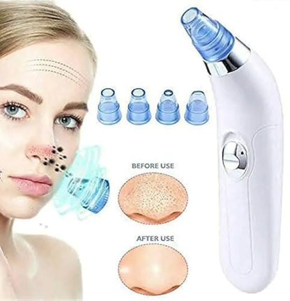 Original 5 in 1 Derma Suction Blackhead Remover Machine