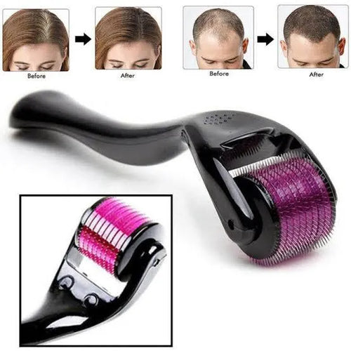 Microneedle Derma Roller 0.5mm for Men & Women – Hair Growth